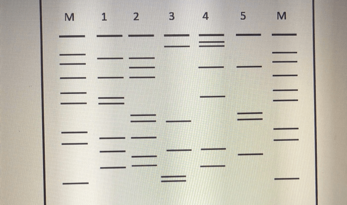 Dna fingerprinting worksheet answer key